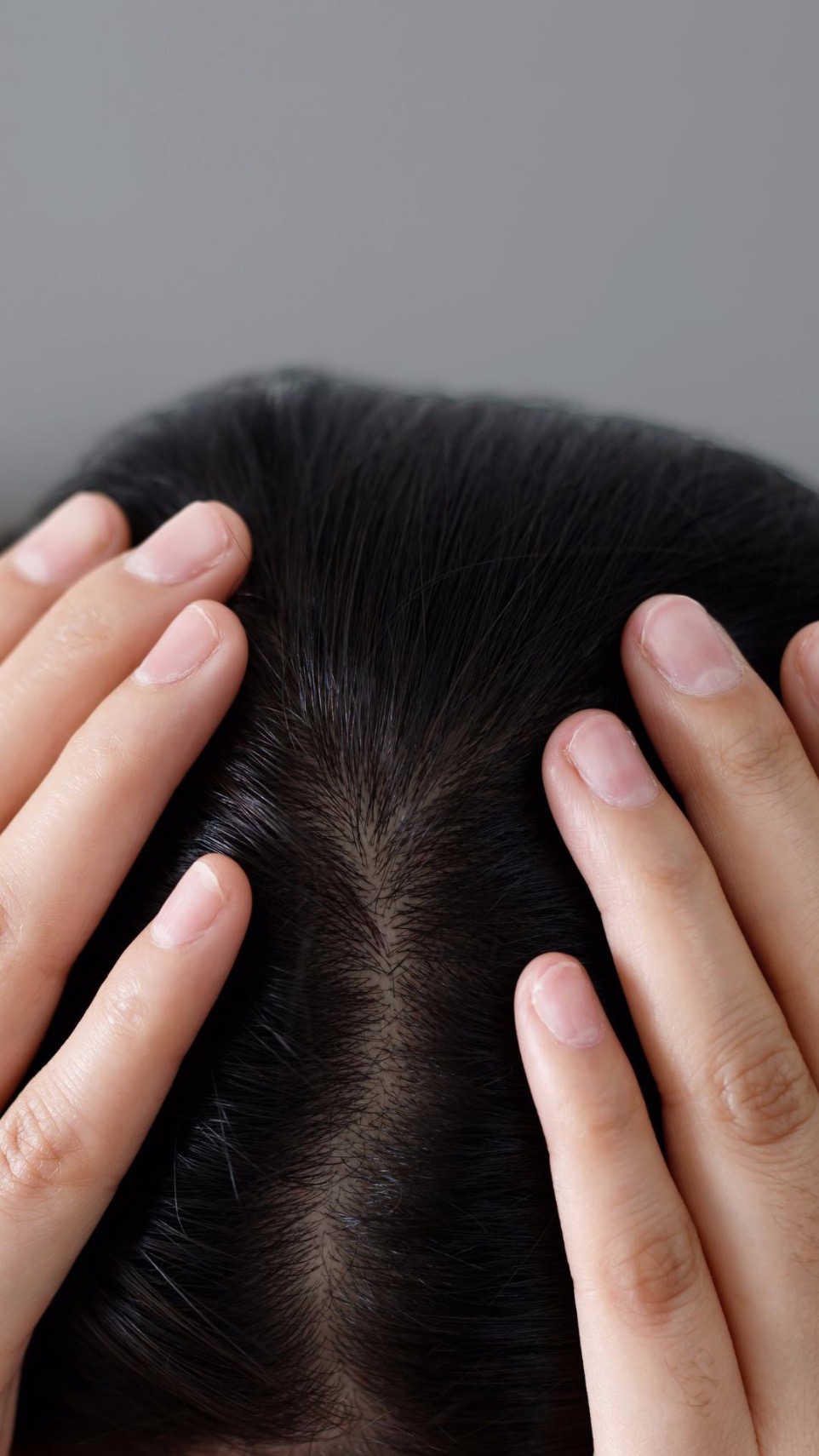 Kopfhautprobleme Exklusive Haarpflegeprodukte von Hair by Ulli – Professionelle Pflege für gesundes, glänzendes Haar.